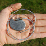 pacemaker Photo by By Steven Fruitsmaak via Wikimedia Commons